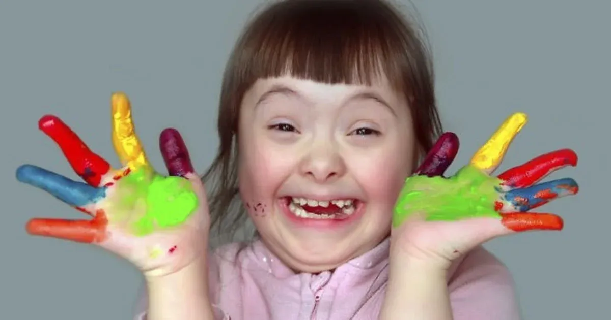 dia-mundial-del-sindrome-de-down-por-que-fue-instituido-el-21-de-marzo